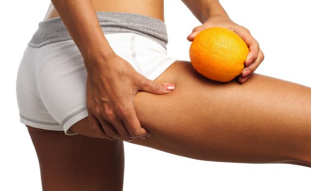 Mesotherapy cellulite treatment image 1